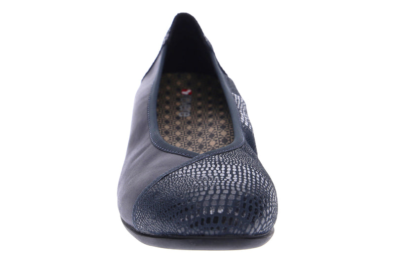 plantar fasciitis