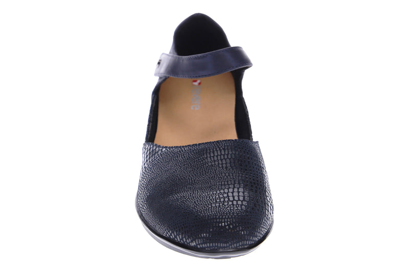 plantar fasciitis
