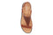 bunions