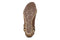 bunions